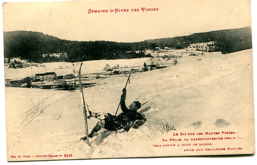 La pelle